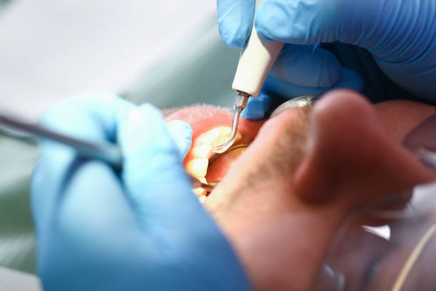 Best Emergency Orthodontic Repairs in Monte Alto, TX