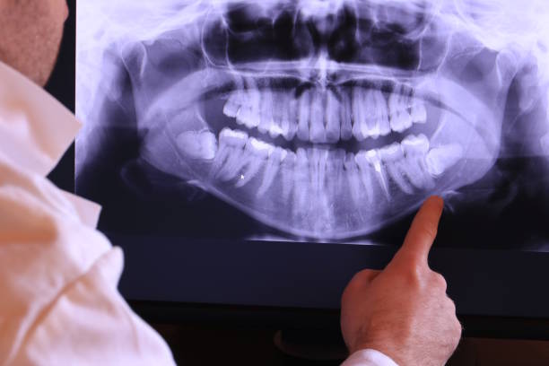 Best Same-Day Emergency Dentist in Monte Alto, TX