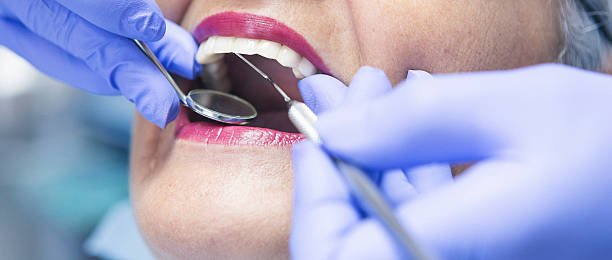Best Emergency Wisdom Teeth Removal in Monte Alto, TX